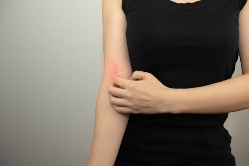 857肩 かゆい 処理